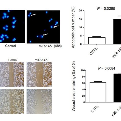 Exogenous MiR 145 Induces Apoptosis In And Inhibits Cell Migration Of