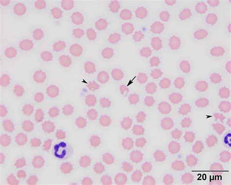 Keratocytes Eclinpath