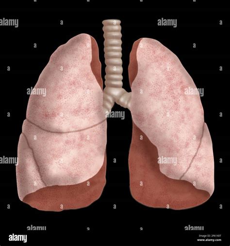 Menschliche Anatomie Der Lunge Fotos Und Bildmaterial In Hoher