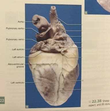 Heart external labeling pt 2 Diagram | Quizlet