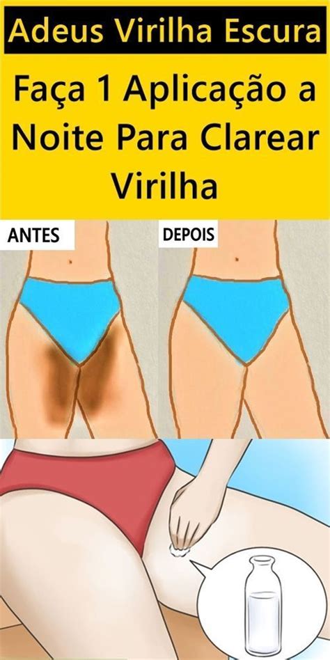 Tratamientos Naturales Para Aclarar La Entrepierna Clarear Virilhas