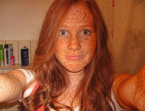 Lots Of Freckles Fyrcxfz Beautiful Freckles