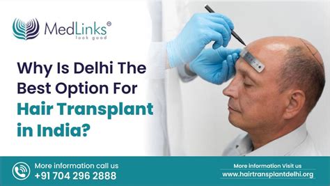 Top 128 Leading Hair Transplant Surgeons In India