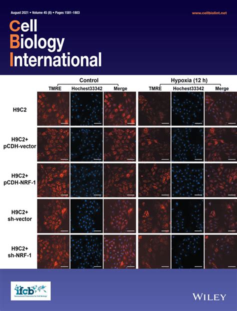 Tymsos Drives The Proliferation Migration And Invasion Of Gastric