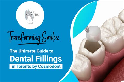 Transforming Smiles The Ultimate Guide To Dental Fillings In Toronto By Cosmodont Cosmodont