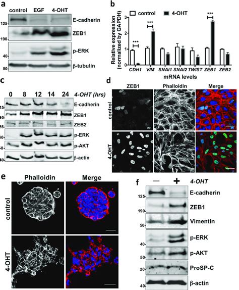 Activation Of Ras Signalling Induces Emt In Alveolar Epithelial Cells