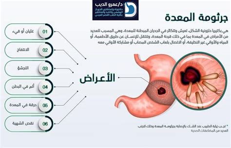 التخلص من جرثومة المعدة نهائيا دكتور عمرو الديب