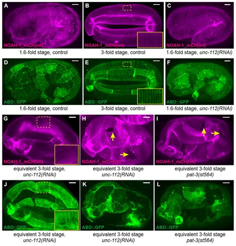 Fig S9 Muscle Contractions Affect Embryonic Sheath Remodeling