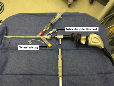 The Use Of Cystosure To Enable Posthysterectomy Cystoscopic Evaluation