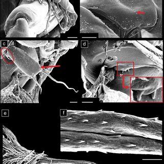 Scanning Electron Microscope Photomicrographs Of The Full Ventral Image