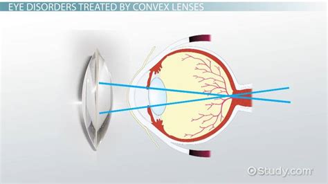 Convex Lens | Definition, Equation & Types - Video & Lesson Transcript | Study.com