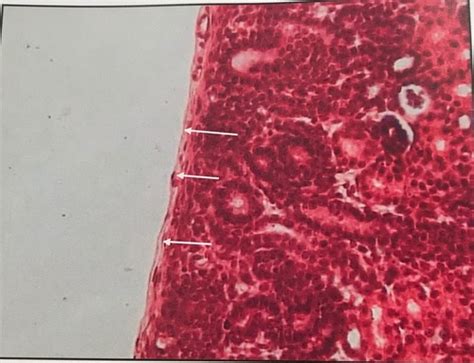 Epithelial TIssues Flashcards | Quizlet