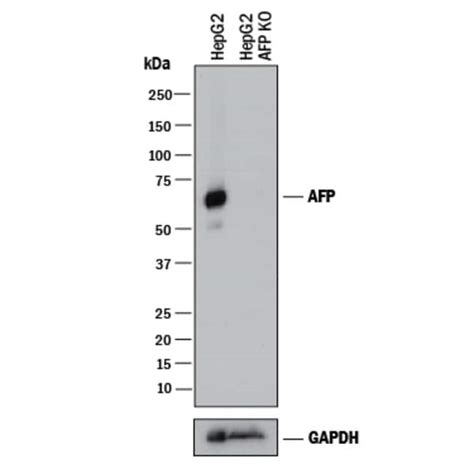 Humanmouse Alpha Fetoproteinafp Antibody R D Systems 100ug