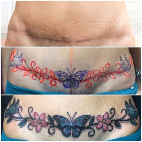 +23 Tattoos Over Tummy Scars Ideas - Fashion Info