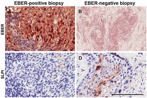 Representative Examples Of Secretory Leukocyte Protease Inhibitor