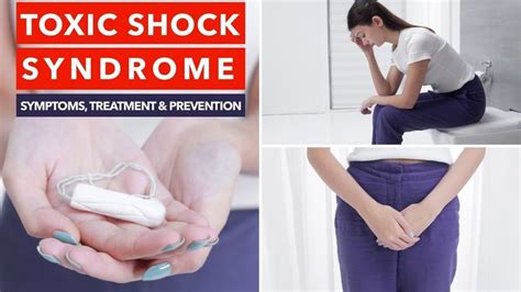 Toxic Shock Syndrome Causes Symptoms And Prevention Youtube