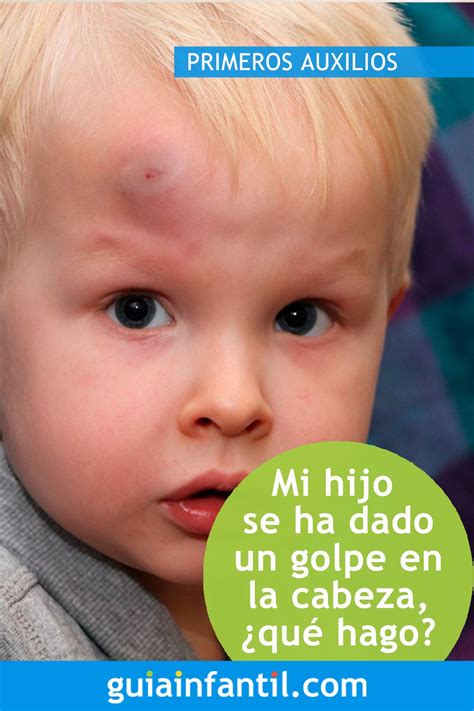 Mi Hijo Se Ha Dado Un Golpe En La Cabeza Chichones O Bodoques En Niños