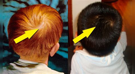 97 Imagenes Corte De Cabello Para Niños Con Dos Remolinos Fotos