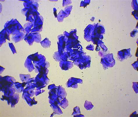 Cytology For Fertility Timing Unlocking The Key To Successful Canine