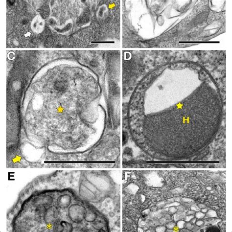 Transmission Electron Microscopy Analysis Of Autophagosomes In