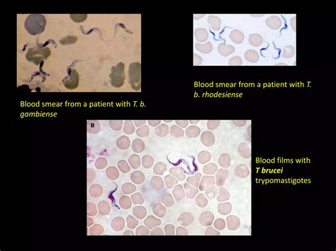 Trypanosomiasis | PPT