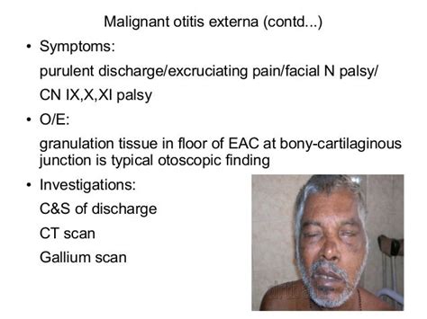 Otitis Externa