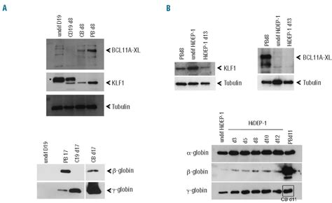 Induction of adult levels of β globin in human erythroid cells that