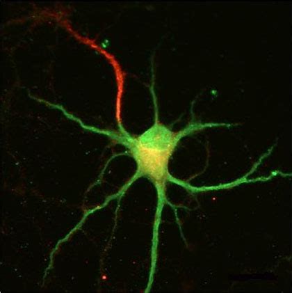 Axons growing out of dendrites? Neuroscientists hate when that happens