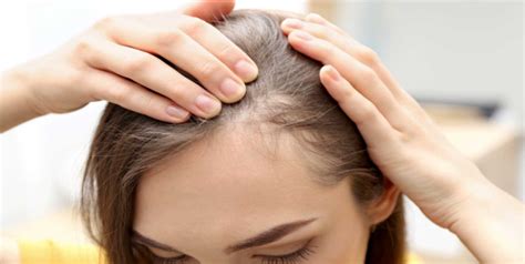 Haz Crecer El Cabello De Las Entradas Con Romero Y Aceite De Ricino