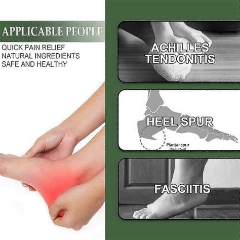 Heel Pain Spray Sole Bone Spurs Arthralgia And Myalgia Heel Pain Sole