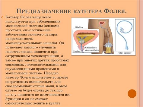 Мочевой пузырь - презентация онлайн