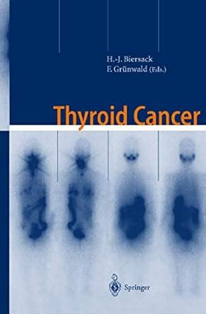 Thyroid Cancer Current Concepts In Diagnosis And Therapy Biersack H