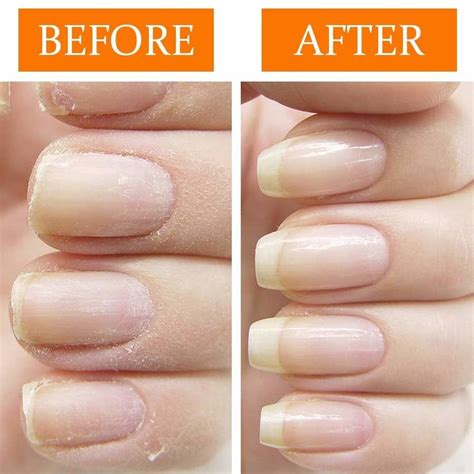 21 Things To Help You Maintain Healthy Nails Artofit