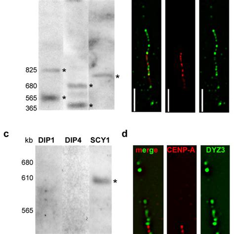 Human Chromosome X HSAX Alpha Satellite DXZ1 Array Size Compared To