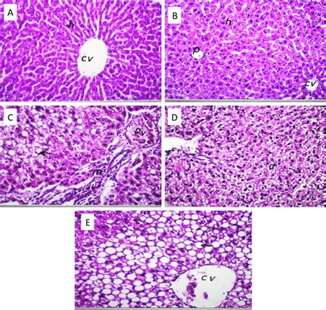 Histology Of Liver Samples From A Control B Treated Group With C Download Scientific