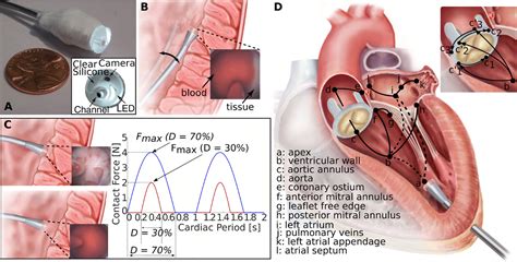 Autonomous Robotic Intracardiac Catheter Navigation Using Haptic Vision