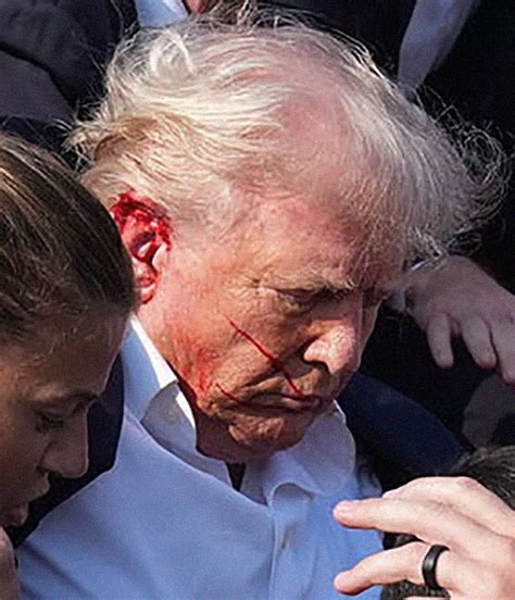 Shot Ripped Off Piece Of Trumps Ear Close Up Pics Graphic