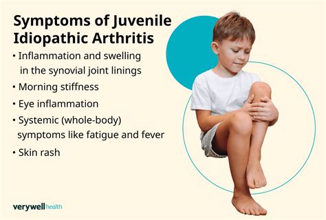 Juvenile Idiopathic Arthritis Symptoms