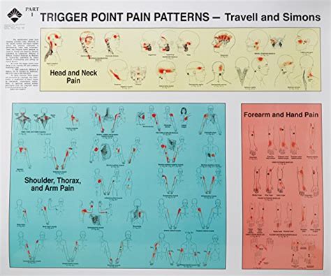 Temporalis Trigger Points And Referred Pain Patterns