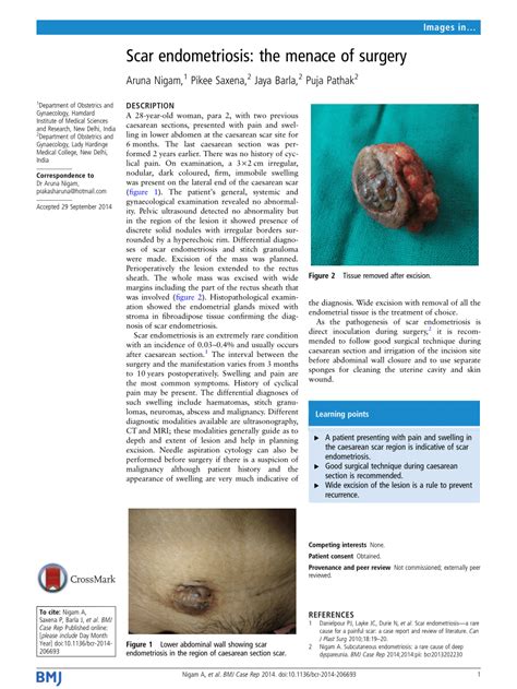 (PDF) Scar endometriosis: The menace of surgery