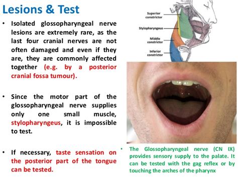 Glossopharyngeal Nerve Origin Course Applied Anatomy