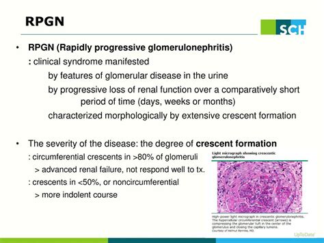 Rapidly Progressive Crescentic Glomerulonephritis Ppt Download