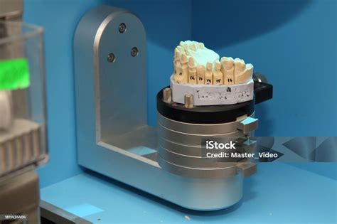 Fabrication Of Dental Crowns And Dentures Made Of Ceramic Scanning Of