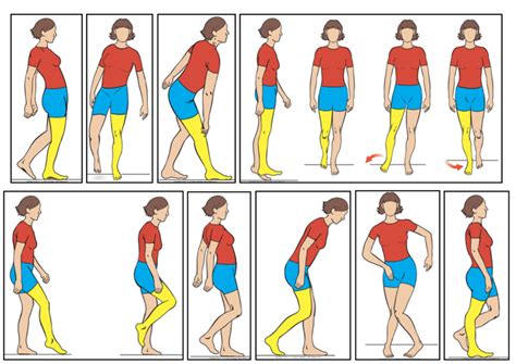 Label Abnormal Gait Diagram Quizlet