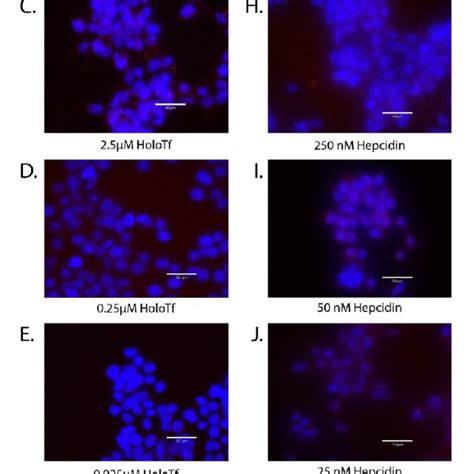 Modulation Of Fpn Internalization By Hepcidin And Holo Tf Hek 293 Download Scientific Diagram