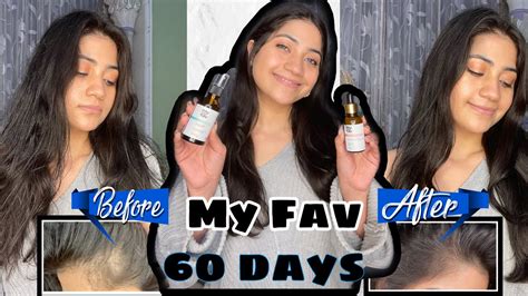 My Favourite Hair Care Products My Fav Hair Fall Control Serum And Anti Frizz Hair Mist