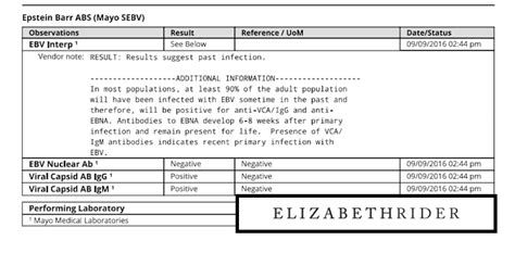 How To Read Ebv Interpretation Chart: A Visual Reference of Charts ...