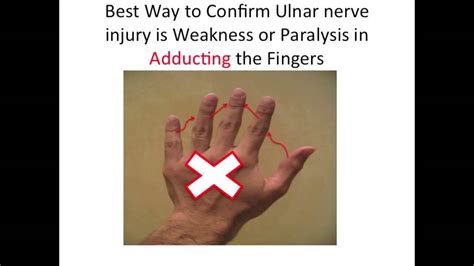 Ulnar Nerve Impingement