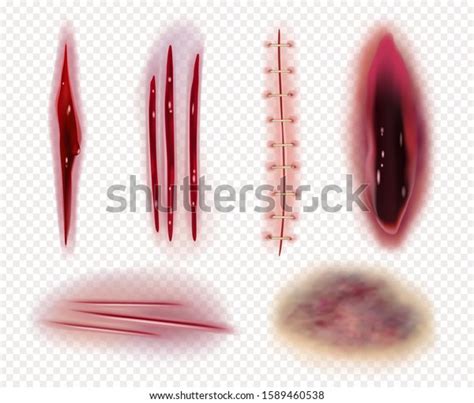 Realistic Scars Cuts Wounds Bruises Bruises Stock Vector Royalty Free