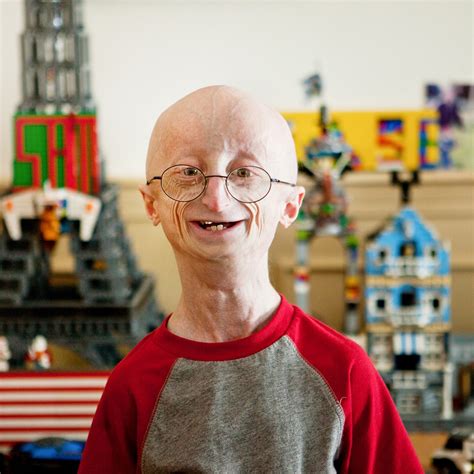 Progeria Sam Berns